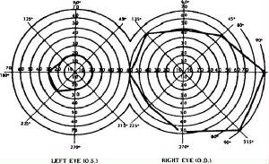 Goldmann+perimeter+chart